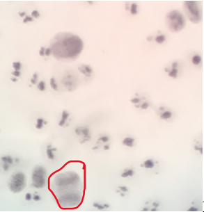 
							
								Microscope field with several cells visible. The circled cell has two distinct, attached lobes. 
							
							